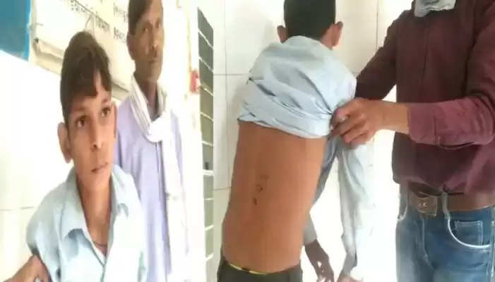 सरकारी स्कूल के टीचर की खौफनाक करतूतः दनादन लात घूंसे मारकर तोड़ दी मासूम की कमर